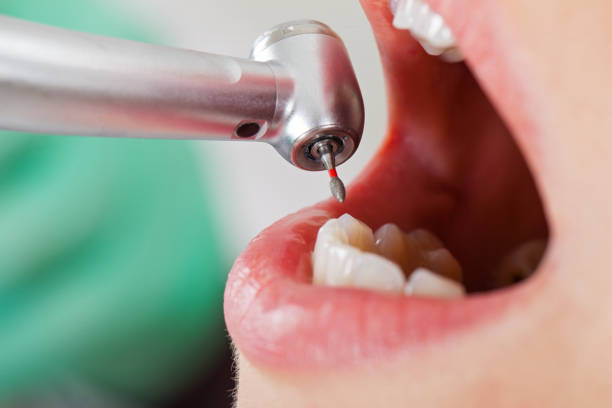 Best Pediatric Emergency Dentist in Anamosa, IA